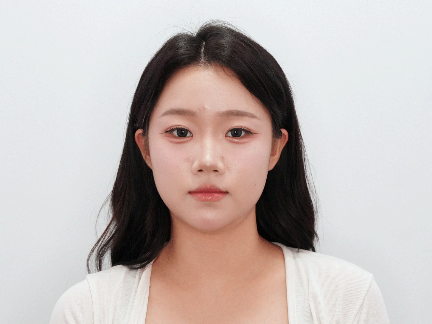 시술 전