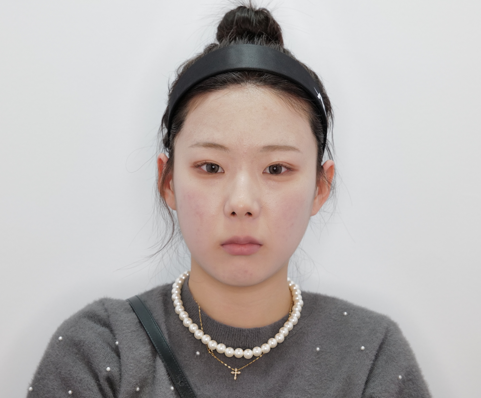 시술 전