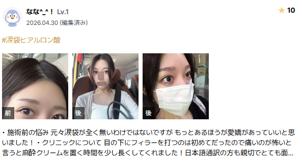 필러 후기